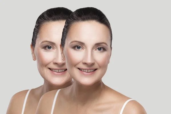 美肌シワ治療手順の前後に中年ブルネット女性の顔 整形手術と美容手順の概念 — ストック写真