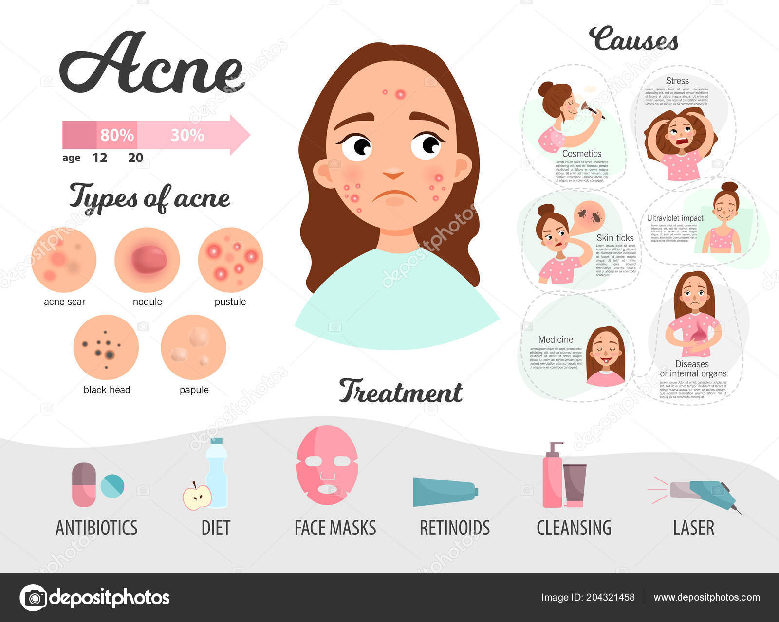 Infographics Acne Causes Disease Treatment Types Acne — Stock Vector