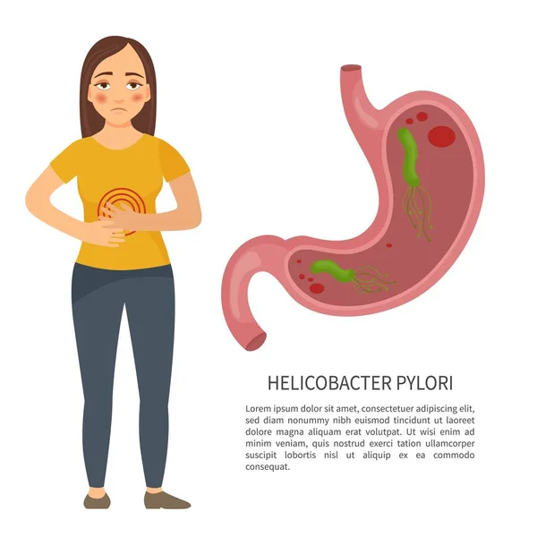Helicobacter pylori. Diseases of the stomach. Flat illustration. A cartoon character. — Stock Illustration Helicobacter Pylori Diseases Stomach Flat Illustration Cartoon Character Royalty Free Stock Vectors