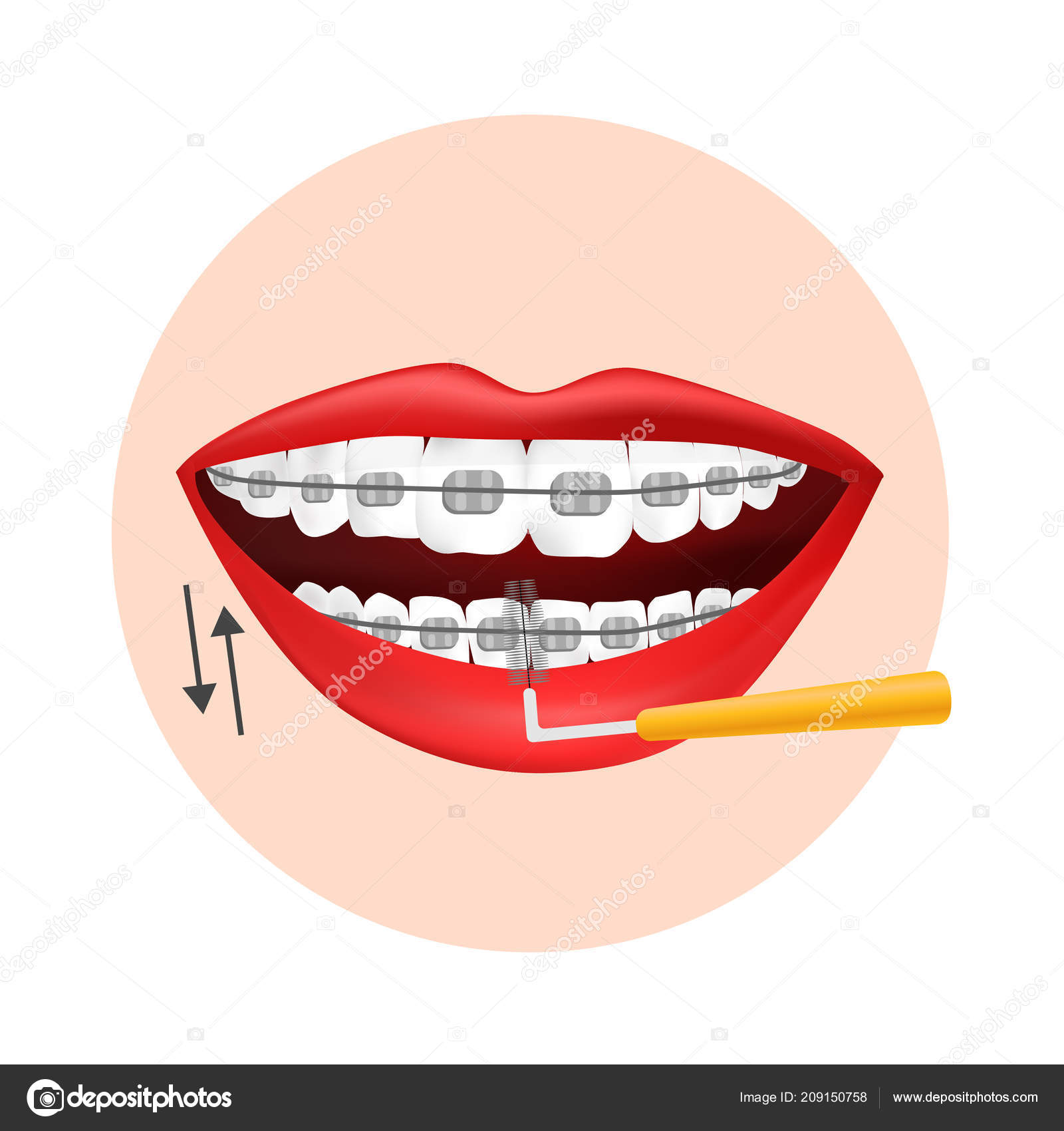 interdental brush ortho