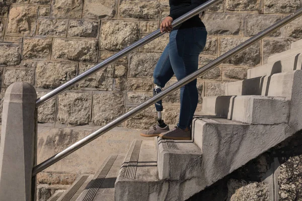 Низкая Часть Женщины Инвалида Спускается Лестнице — стоковое фото