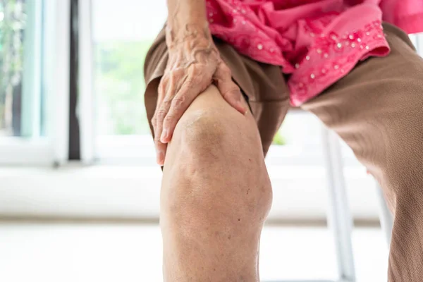 Arthriti, osteoartrite do joelho, mulher idosa sentada na cadeira, segurando a mão no joelho, sentindo dor no joelho, joelhos inchados, conceito médico e de cuidados de saúde — Fotografia de Stock