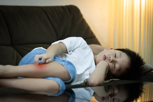男孩儿白天在家里睡觉 小孩用手抓腿 蚊子咬他的腿 昆虫咬他的腿 患登革热的危险 蚊子的危险 — 图库照片
