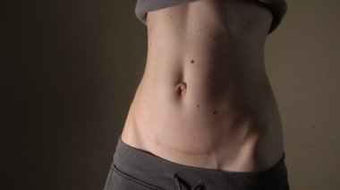 C bölümü Bebek Doğum sonrası kurtarma anne tutan sezaryen operasyon iyileşmek