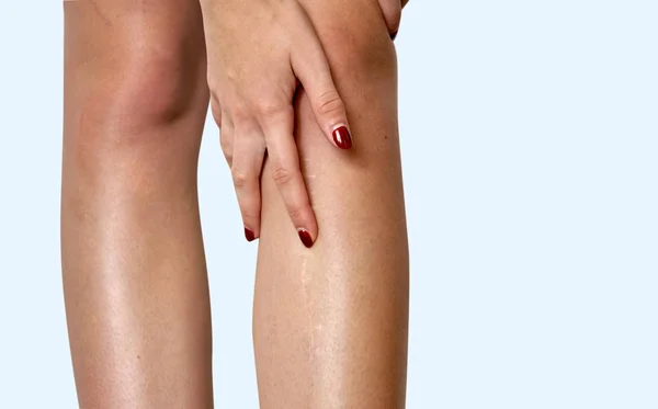 ヘルスケアの概念。膝の痛みに苦しむ女性膝に手をつないで分離 — ストック写真