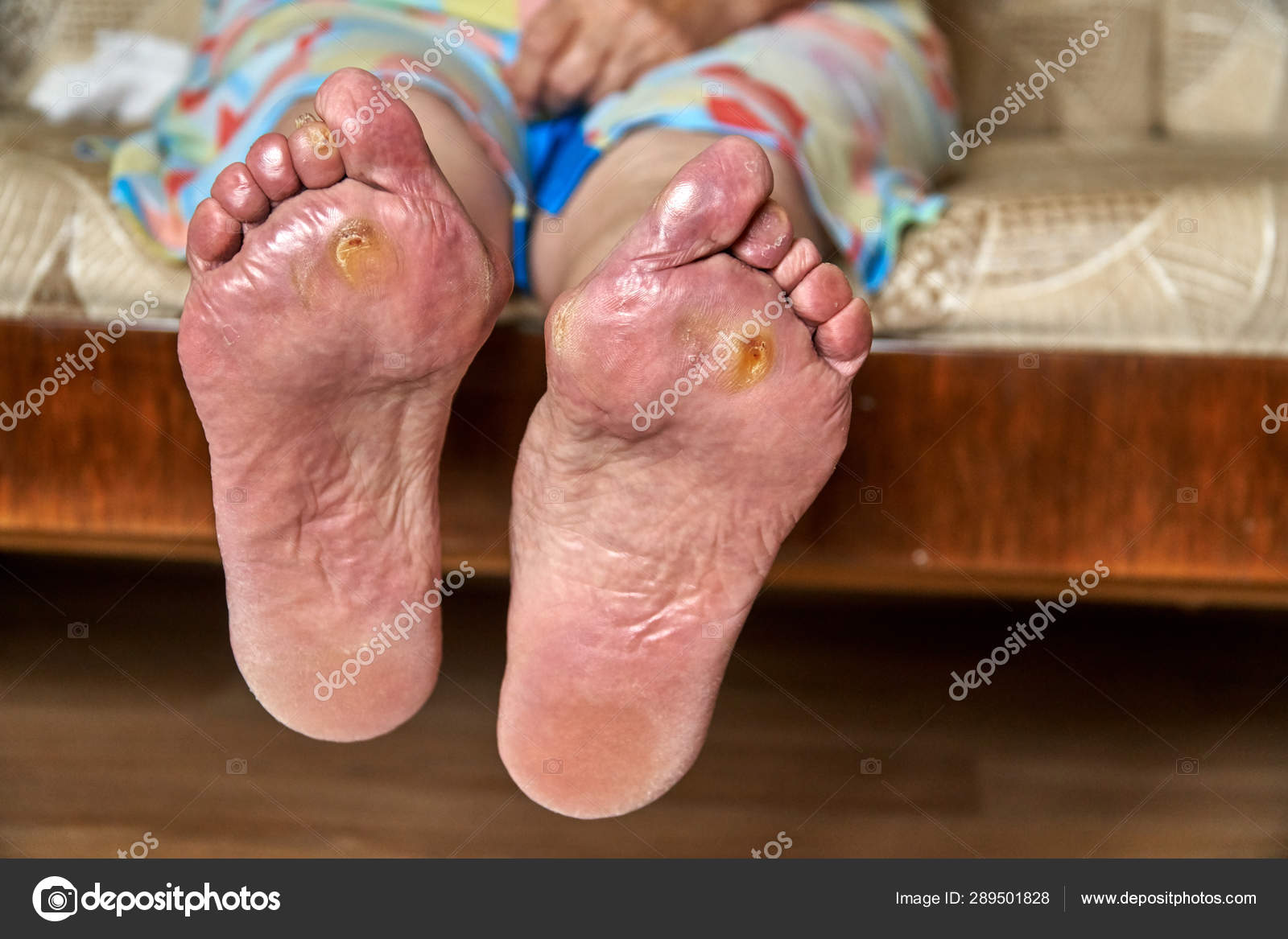 Wrinkled Soles Cars Wrinkled Soles Cars