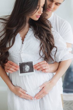 Genç evli çift ultrason taraması tutuyor