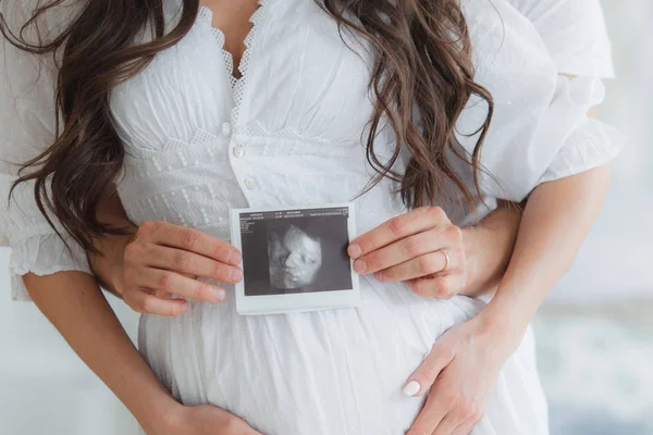 Casal jovem está segurando uma ultra-sonografia — Fotografia de Stock