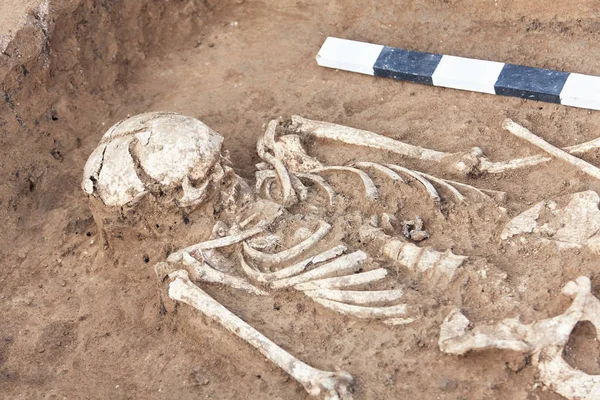 Archäologische Ausgrabungen Menschliche Überreste Skelettknochen Schädel Boden Mit Artefakten Die — Stockfoto