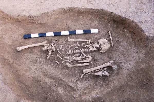 Archeologische Opgravingen Mens Blijft Botten Van Het Skelet Schedels Het — Stockfoto