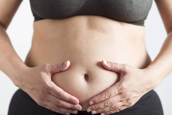 太りすぎの女性の腹 — ストック写真