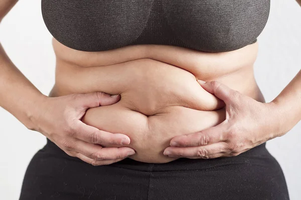 太りすぎの女性の腹 — ストック写真