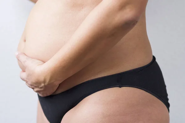 太りすぎの健康問題を引き起こすことができる胴体に — ストック写真