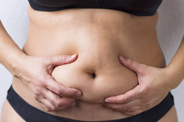 Sobrepeso Torso Que Puede Causar Problemas Salud — Foto de Stock