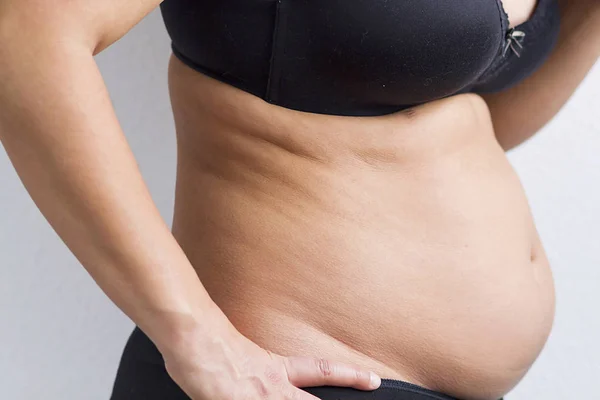 Sobrepeso Torso Que Puede Causar Problemas Salud —  Fotos de Stock