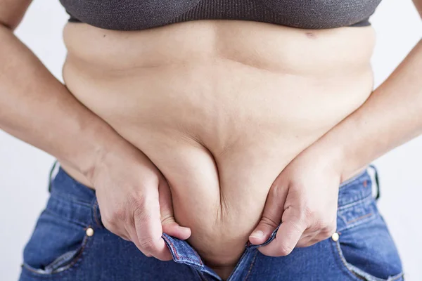 A womans belly with overweight