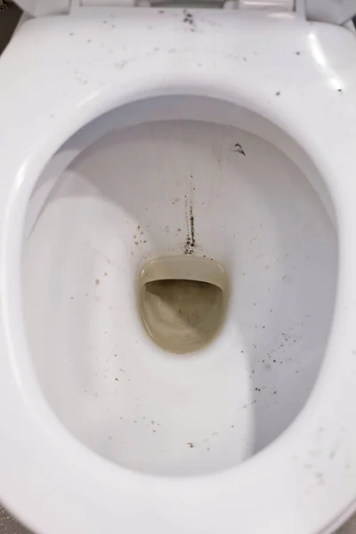 Zeer Vuile Verwaarloosde Toiletpot — Stockfoto