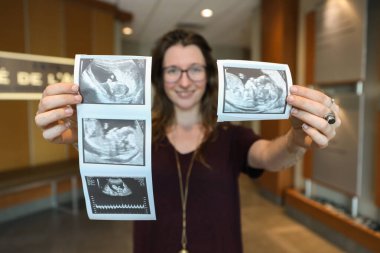 Hamile kadınların ekografi randevusu..