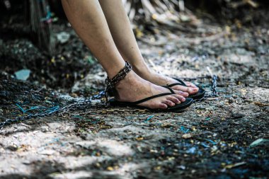 Ven ödemi kadınların ayak yaralanma ground yakınındaki metal zincir asılı içerir.