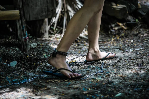 Ven ödemi kadınların ayak yaralanma ground yakınındaki metal zincir asılı içerir.