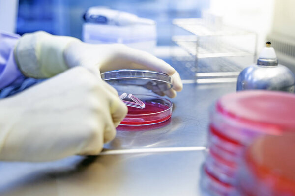 Hands of scientists are working on research.Bacteria in agar sheets, laboratory tests for infection, growth of Gram-negative bacteria, Gram-negative bacteria, Gram-positive bacteria, alpha 