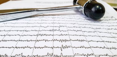 Elektroensefalogram ve nörolojik çekiç doktor masada