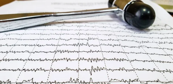 Électroencéphalogramme Marteau Neurologique Sont Sur Table Chez Médecin Praticien — Photo