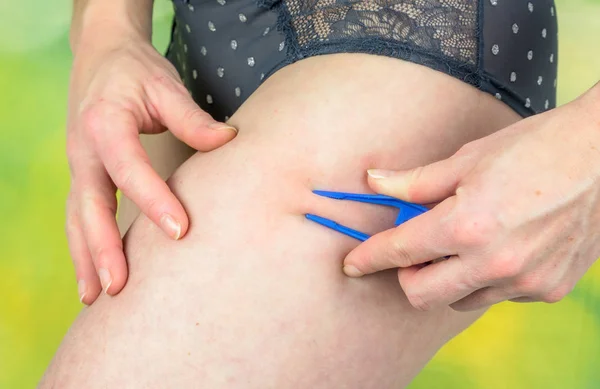 woman doing a cellulite test on her thigh. Healthy lifestyles concept with green background