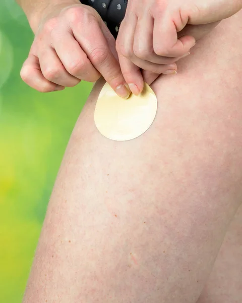 Attraktive Gesunde Frau Die Ein Nikotinpflaster Auf Ihren Oberschenkel Aufträgt — Stockfoto