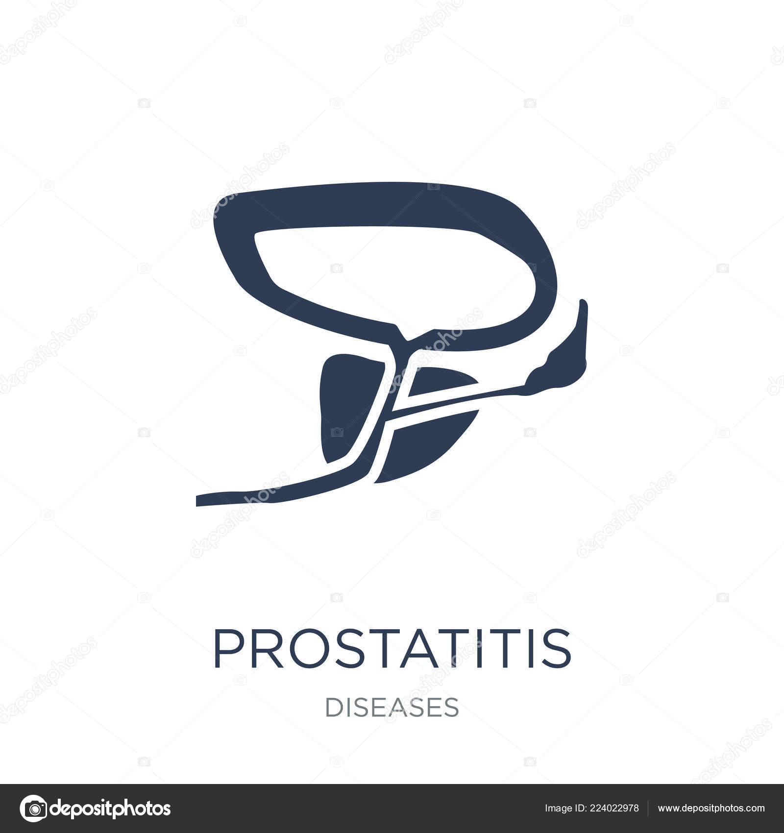 Prostatitis rajz)