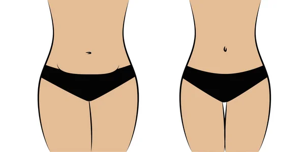 Cuerpo femenino grueso y delgado — Vector de stock