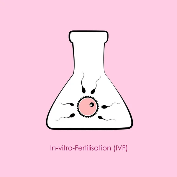 In-vitro-Fertilisation ivf Eizelle und Sperma im Reagenzglas — Stockvektor