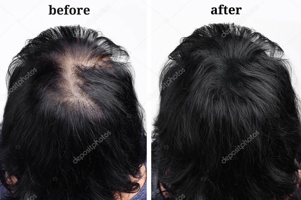 women's hair after using cosmetic powder for hair thickening. Before and after