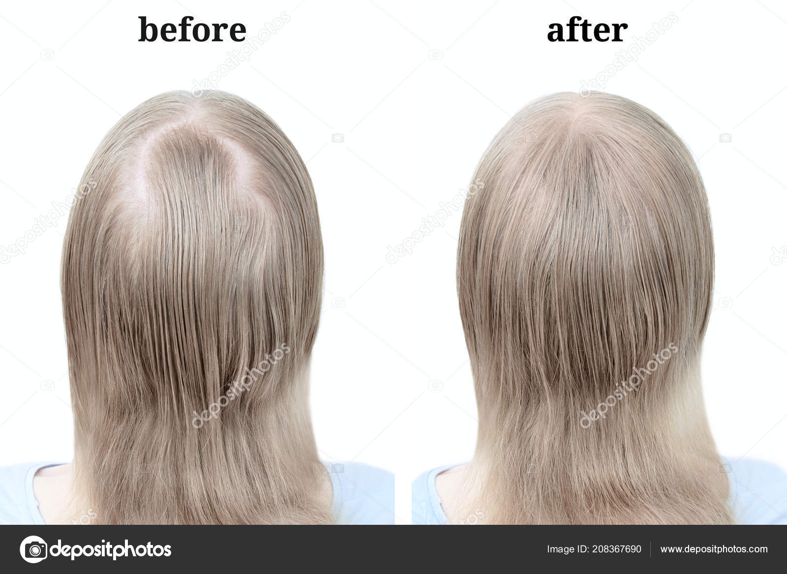 Women's Blond Hair Using Cosmetic Powder Thicken Hair Stock Photo by ©iulal 208367690 Women's Blond Hair Using Cosmetic Powder Thicken Hair Stock Photo by ©iulal 208367690
