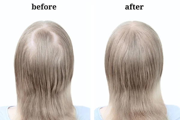 Cheveux Blonds Des Femmes Après Avoir Utilisé Poudre Cosmétique Pour — Photo