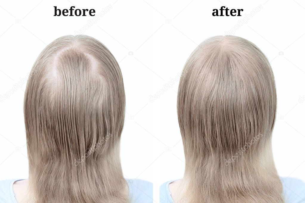 Women's blond hair after using cosmetic powder to thicken hair. Before and after