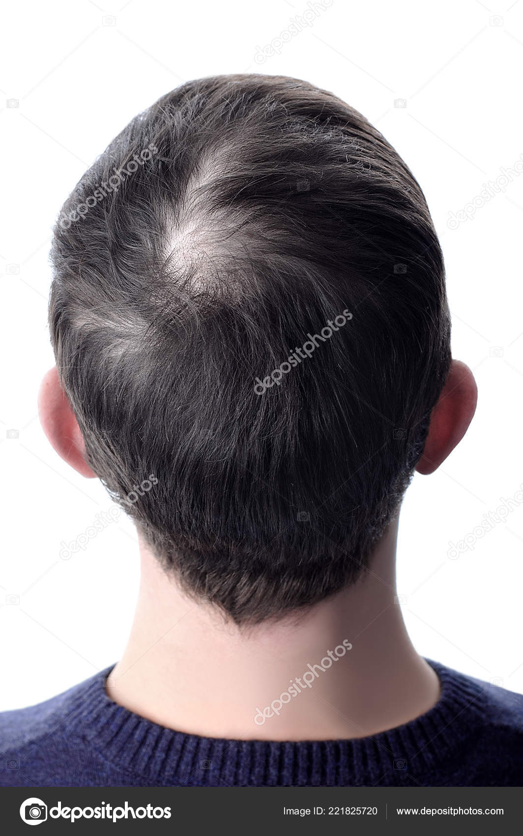 Men Hair Bald Patch Using Cosmetic Powder Thicken Hair White Stock Photo C Iulal 221825720