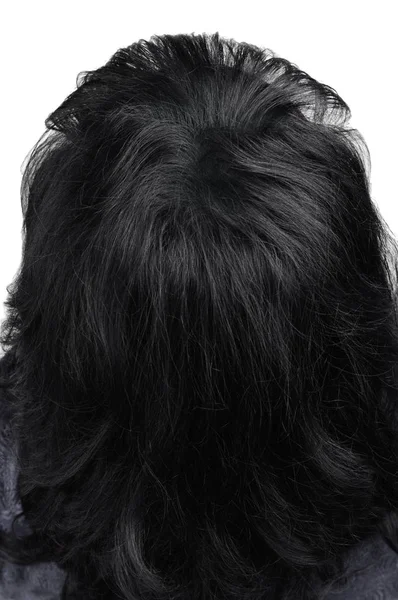 Mulheres Cabelo Depois Usar Cosmético Para Engrossar Cabelo Foto Depois — Fotografia de Stock