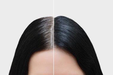 Head of a girl with black gray hair. Hair coloring. Before and after. Close-up. clipart