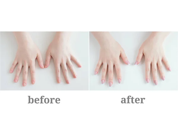Kadın manikür. Önce ve sonra. Kız beyaz bir arka plan üzerinde eller.