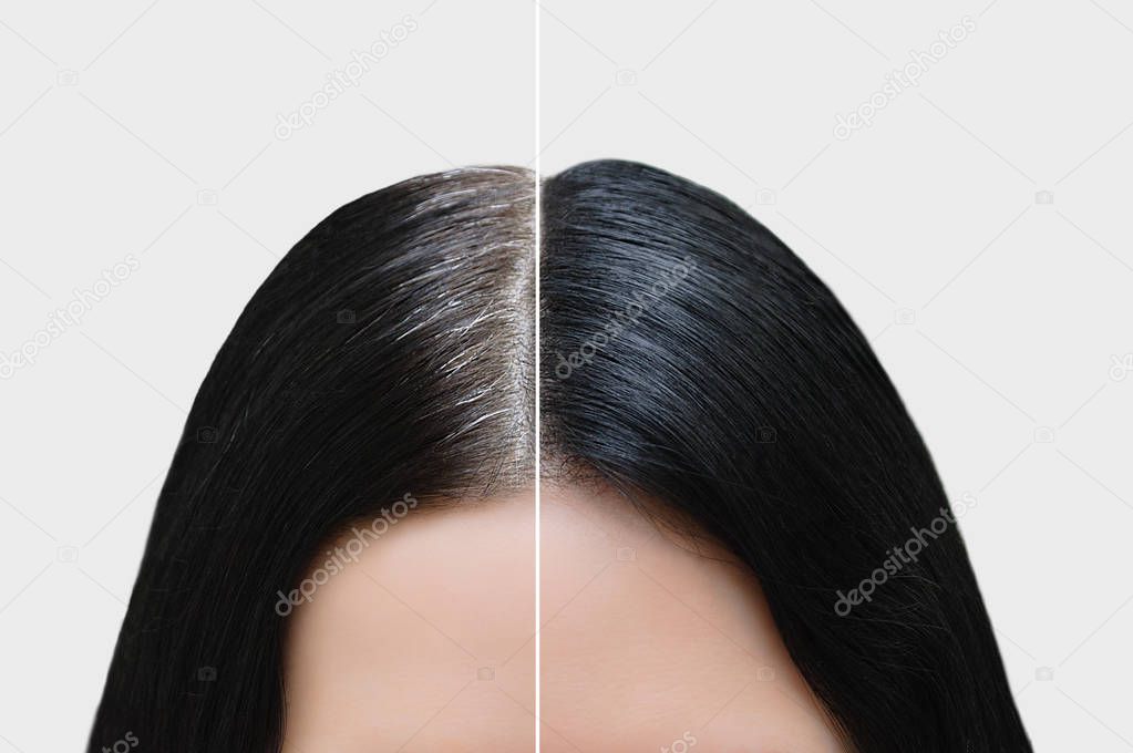 Head of a girl with black gray hair. Hair coloring. Before and after. Close-up.