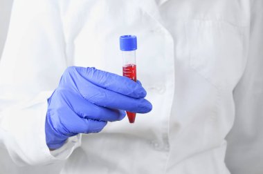 Beyaz bir arka planda elinde test tüpü olan bir laboratuvar doktoru..