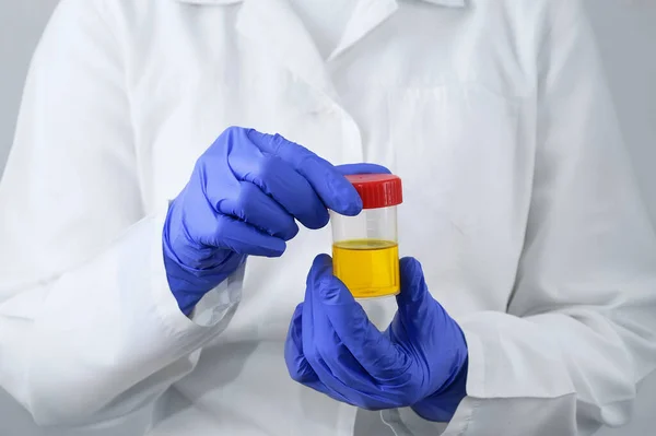 Elinde Bir Kutu Idrar Testiyle Beyaz Bir Arka Planda Laboratuvar — Stok fotoğraf