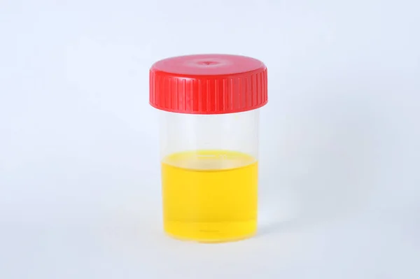 Laboratorium Dapat Dengan Topi Merah Tes Urin Pada Latar Belakang — Stok Foto