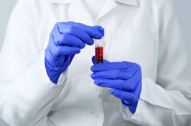 Laboratuvar doktoru, beyaz arka plandaki kan testlerini yakından inceledi..