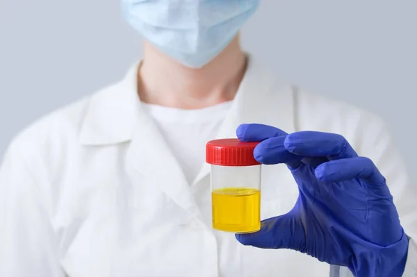 Laboratoriumarts Close Met Een Blik Urinetests Zijn Handen Een Witte — Stockfoto