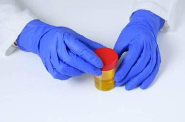 Yakın plan laboratuvar doktoru elinde plastik idrar testi ile beyaz bir arka plan üzerinde duruyor..