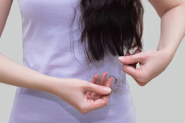 Perda Cabelo Close Mulher Com Pedaços Cabelo Castanho Mão — Fotografia de Stock