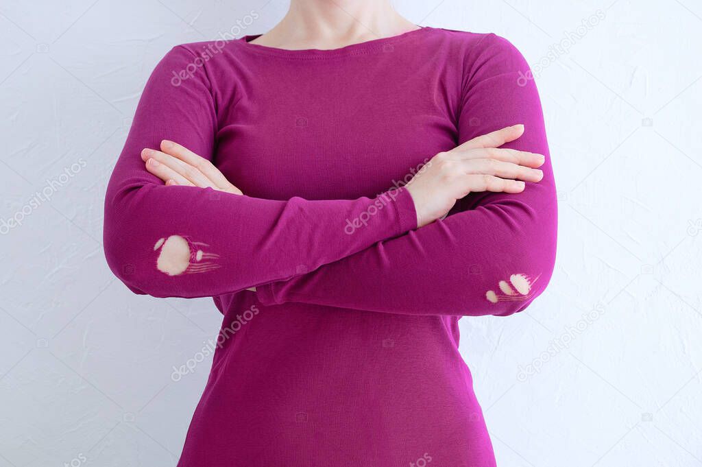 Caucasian woman in purple clothes with holes on the elbows. White background.