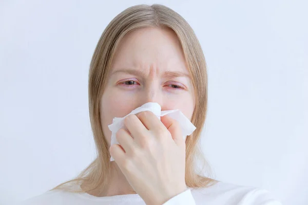 Constipações Gripe Mulher Jovem Branca Espirrando Guardanapo Branco — Fotografia de Stock
